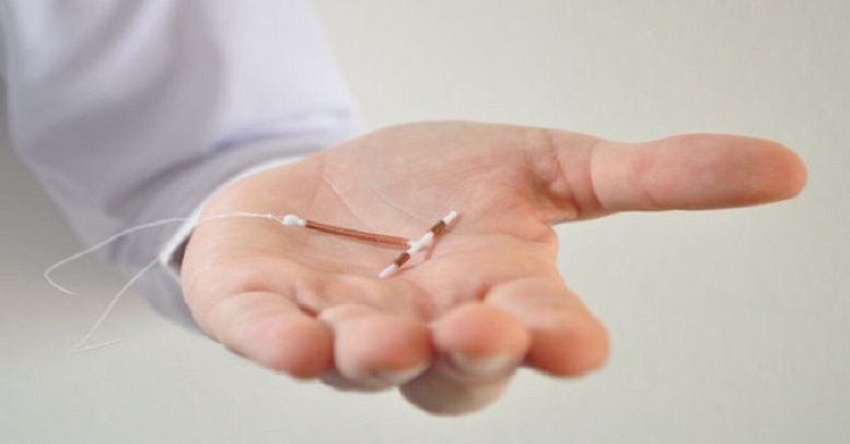 Copper IUD for Teens: A Safe and Long-Lasting Birth Control Choice