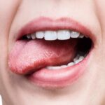 treatment for oral cancer on tongue