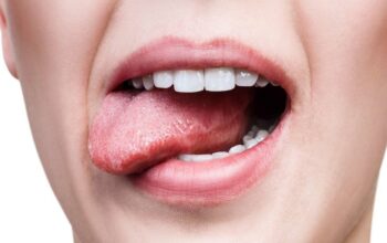 treatment for oral cancer on tongue