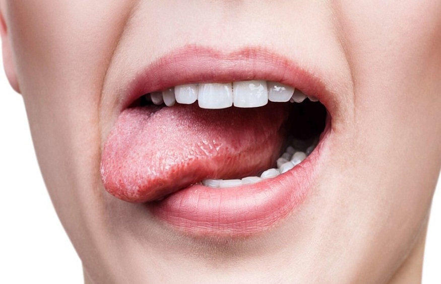 Tongue Cancer: Symptoms, Causes, and Cure