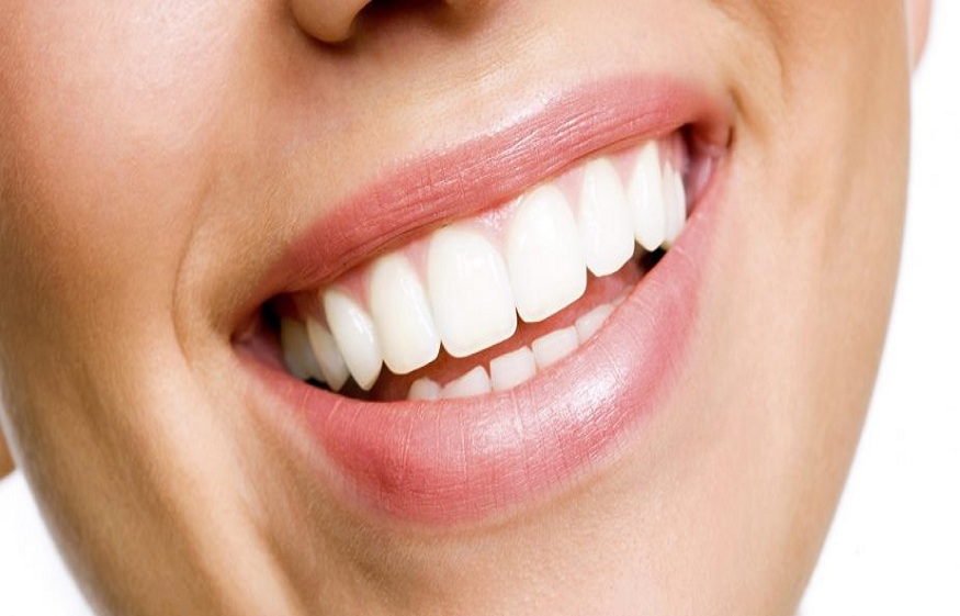 How Much Does Teeth Whitening Cost in Rozelle?