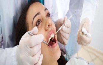 Wisdom Teeth Removal Sydney